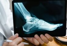 inbound call delay analysis